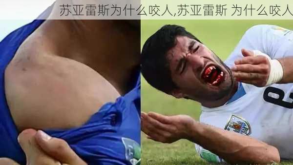 苏亚雷斯为什么咬人,苏亚雷斯 为什么咬人