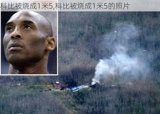 科比被烧成1米5,科比被烧成1米5的照片