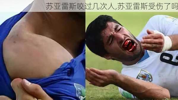 苏亚雷斯咬过几次人,苏亚雷斯受伤了吗